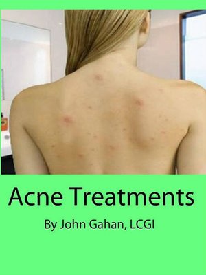 cover image of Acne Treatments
